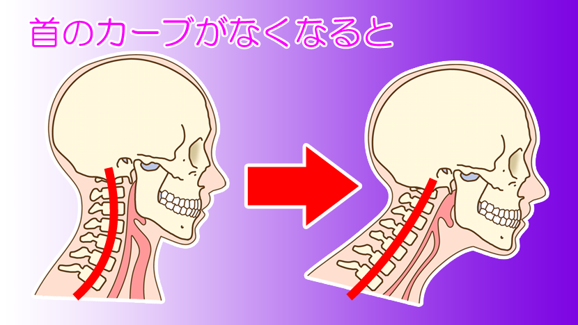 ストレートネックってなに？