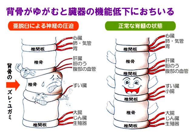 背骨が歪むと臓器の機能低下におちいる