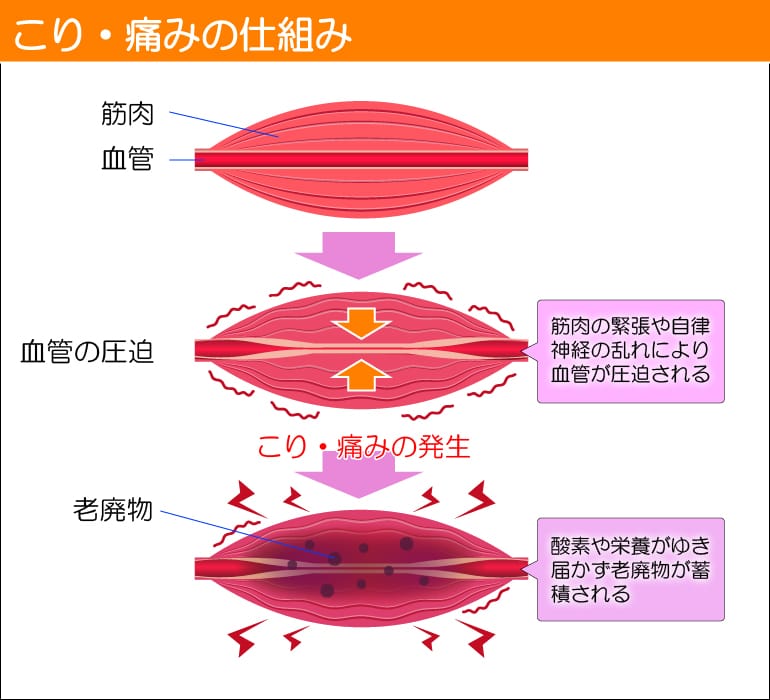 コリ・痛みの仕組み