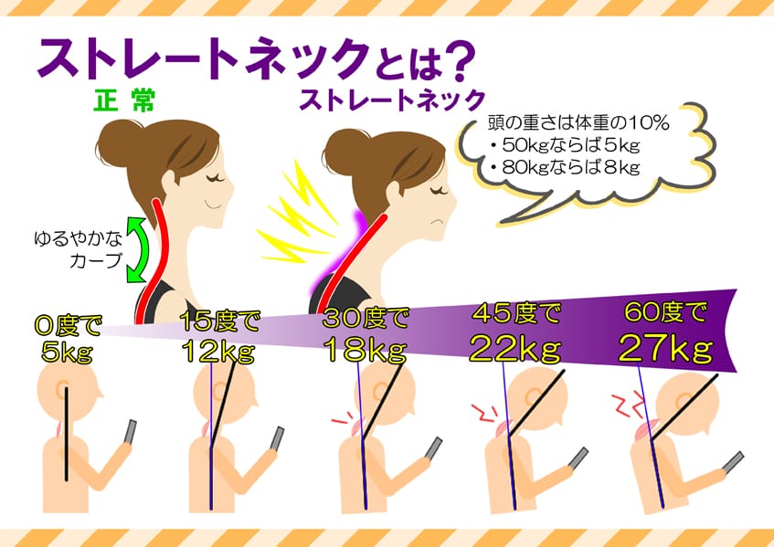 ストレートネックとは?